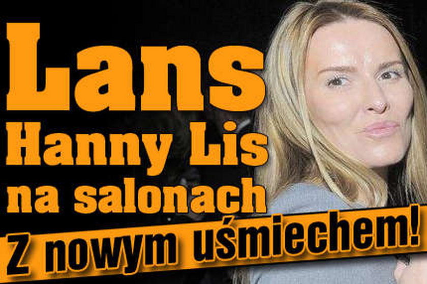 Lans Hanny Lis na salonach. Z nowym uśmiechem!