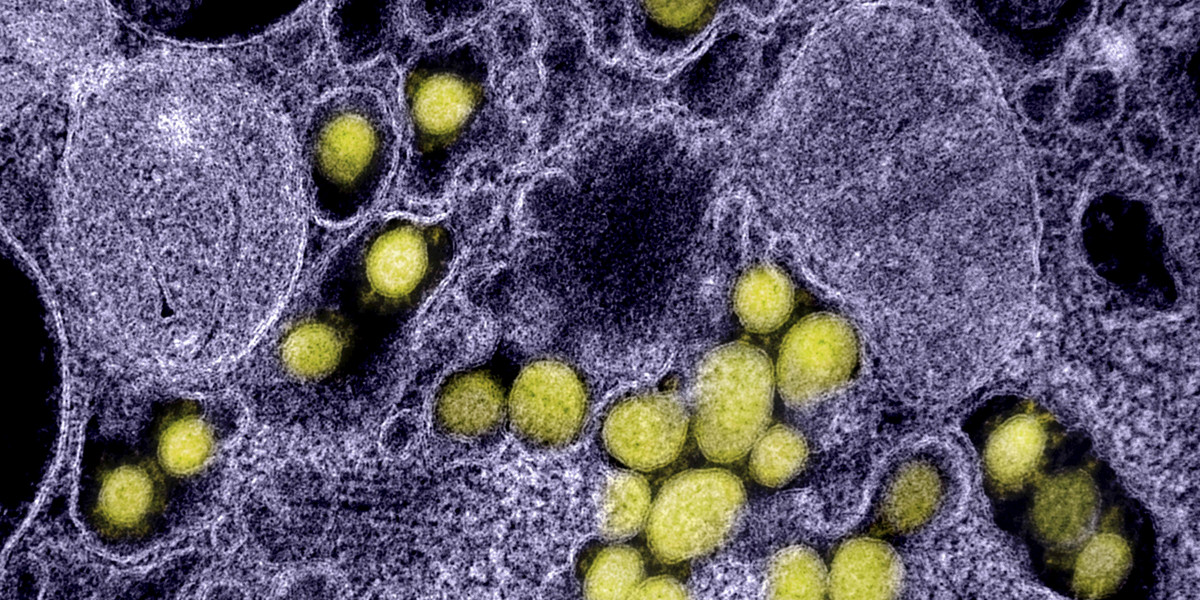 Koronawirus widoczny pod mikroskopem elektronowym