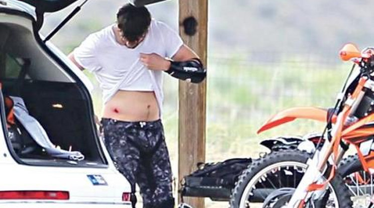 Megsérült motorozás közben Ashton Kutcher
