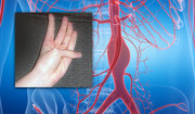 Test kciuka pozwoli ocenić ryzyko tętniaka aorty