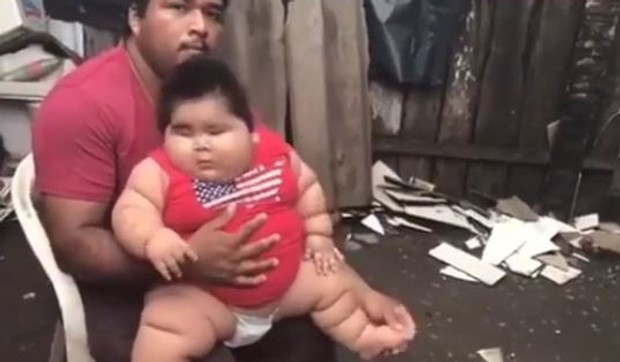 luis manuel beba  sindrom