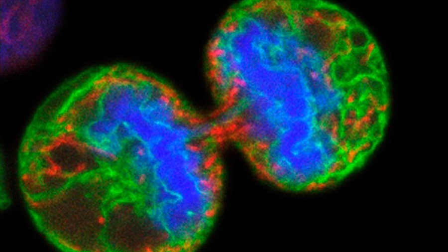 Rozpoczęły się testy terapii z wykorzystaniem mRNA w leczeniu nowotworów, fot. Paul J.Smith/ Rachel Errington/ CC BY 4.0/ Wellcome Collection. Na zdjęciu uchwycono podział komórek czerniaka.