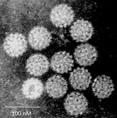 Przyjmuje się, że nawet około 50 proc. populacji ludzkiej w ciągu swojego życia przechodzi zakażenie HPV, które posiada wiele szczepów. Niektóre są onkogenne / Wikimedia Commons