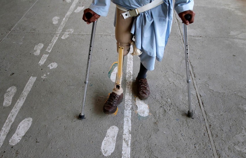 Na hiljade ljudi ostalo je bez udova zbog nagaznih mina