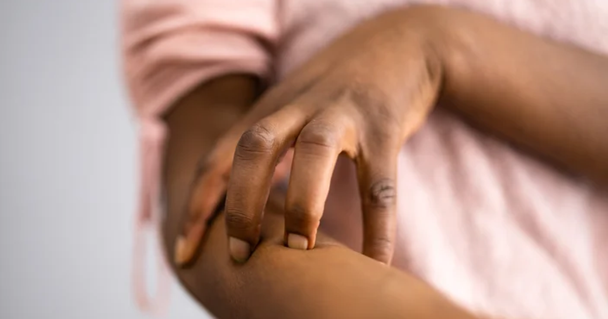 5 Reasons Your Body Itches After A Bath Pulse Nigeria