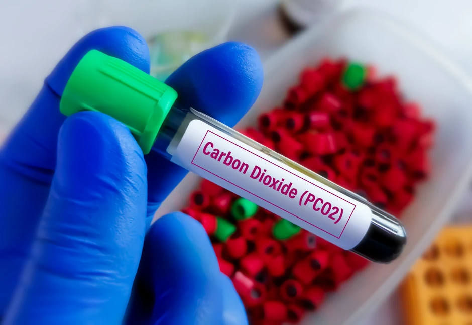 Srčana, plućna, mišićna i neurološka oboljenja dovode u veći rizik od hiperkapnije  