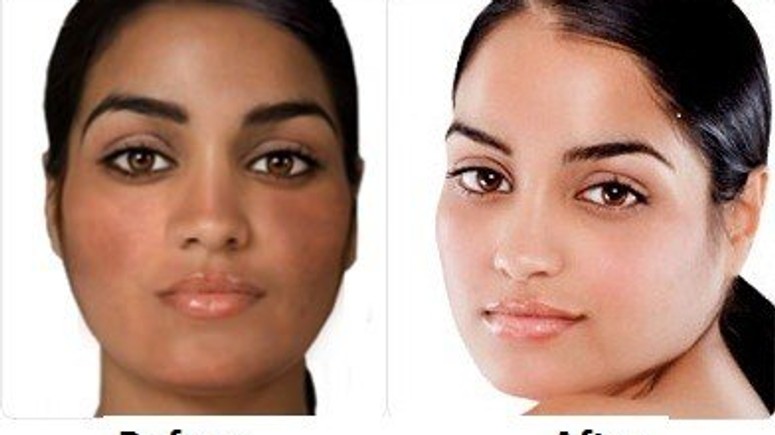 Skin bleaching: We must stop linking fair skin with beauty and success - CNN