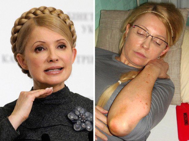Julia Tymoszenko przerywa głodówkę