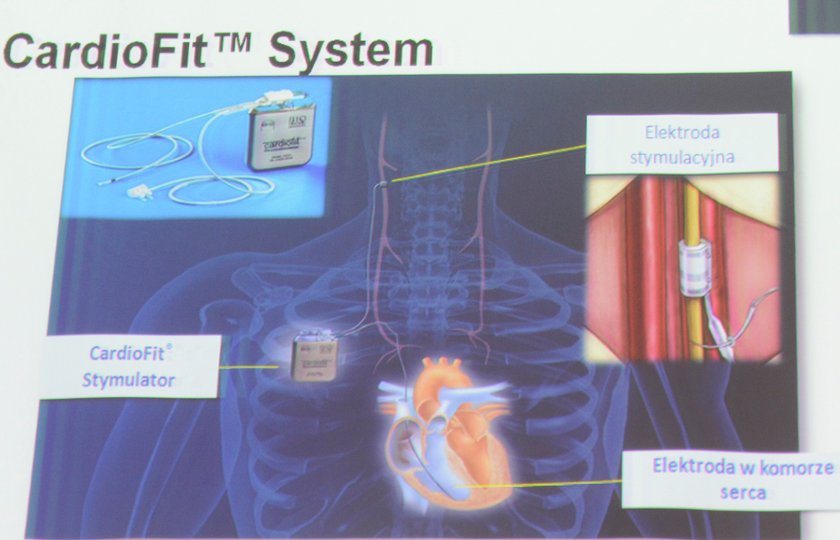 Stymulator Cardio Fit