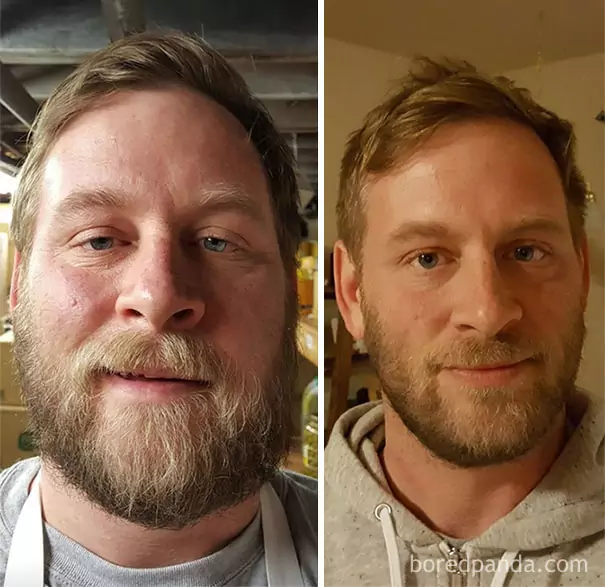 before-after-sobriety-photos-61
