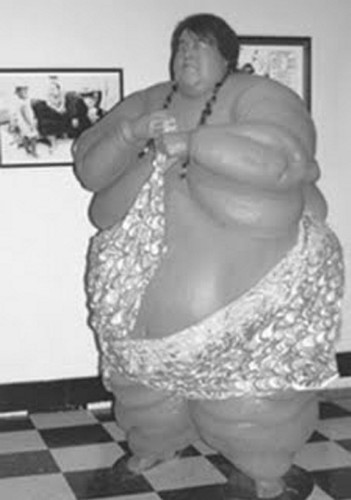 Minnoch, pracujący jako taksówkarz miał 183 cm wzrostu a jego rekordowa waga to prawdopodobnie około 635 kilogramów.