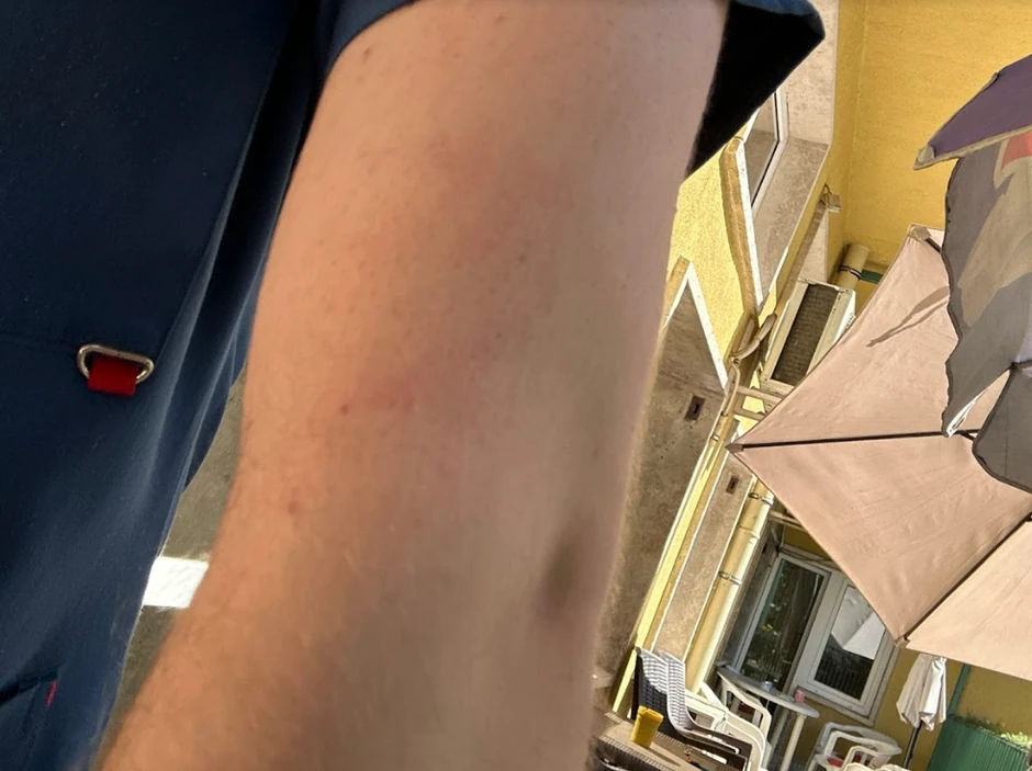 Povrede Uroša Stanića