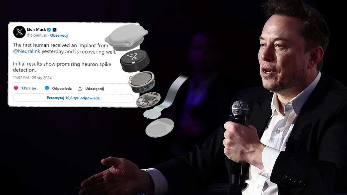 Firma Elona Muska wszczepiła pierwszemu człowiekowi chip do mózgu