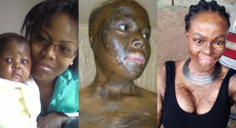 Woman recalls how she lost her daughter after lover set them ablaze