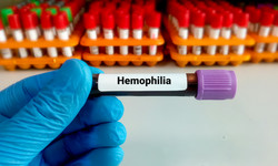 Narodowy program to szansa dla osób z hemofilią. Dzięki niemu mogą normalnie żyć