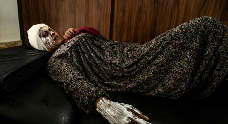 Syrian patient Fatima al-Issa who was hit by shrapnel during Turkish bombardment of Ras al-Ain, rests after receiving treatment at a hospital in the town of Tal Tamr in the countryside of Syria's northeastern Hasakeh province, on October 11, 2019.Ankara stepped up its assault on Kurdish-held border towns in northeastern Syria in an offensive that has so far displaced some 100,000 people, according to the United Nations, while aid groups have warned of yet another humanitarian disaster in Syria's eight-year-old war if the offensive is not stopped