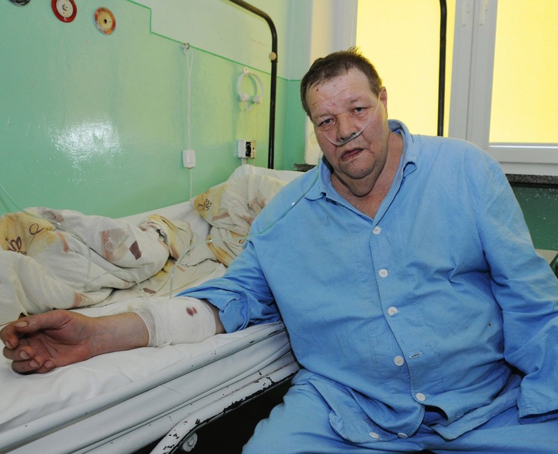 Pan Stanisław o mało nie stracił ręki