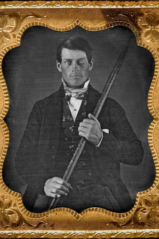 13 września 1848: Pracownik kolei Phineas Gage (1823-1860) przeżywa wypadek, w którym żelazny pręt przebija mu czaszkę.