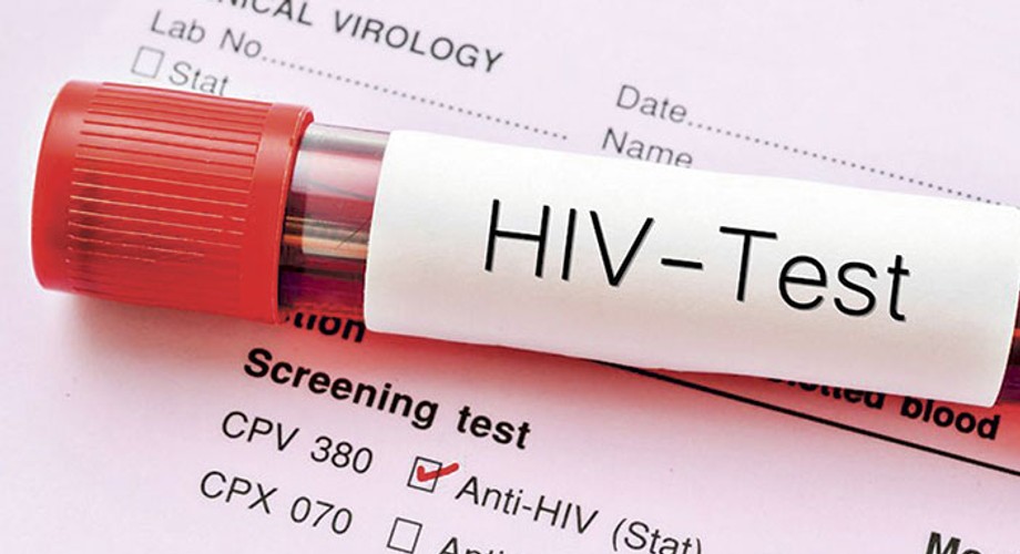 HIVPositive and ‘Undetectable’ What does it mean? Pulse Nigeria