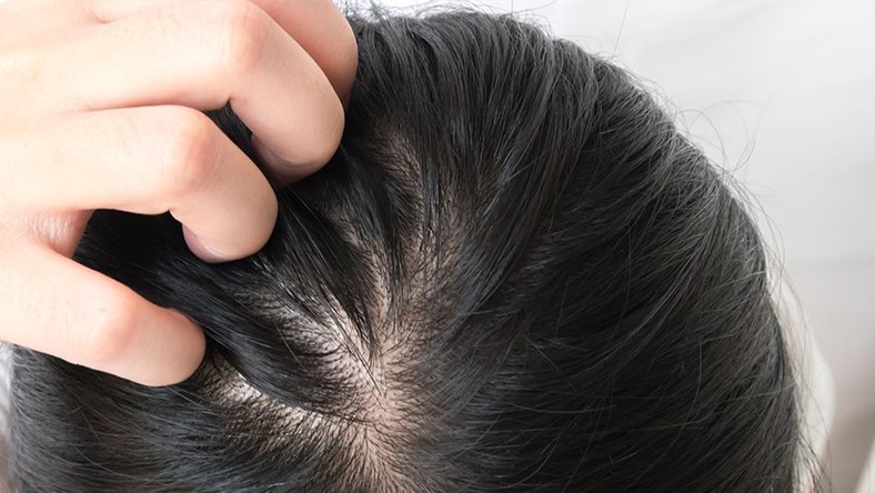 14 Best Shampoos For Thinning Hair Article Pulse Ghana