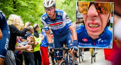 Dramat kolarza na Tour de France. Konieczna była wizyta u dentysty