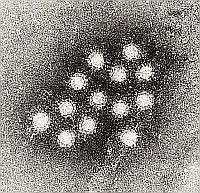 hepatitis-a-virus-02-d000011DDb9371f48dc4a