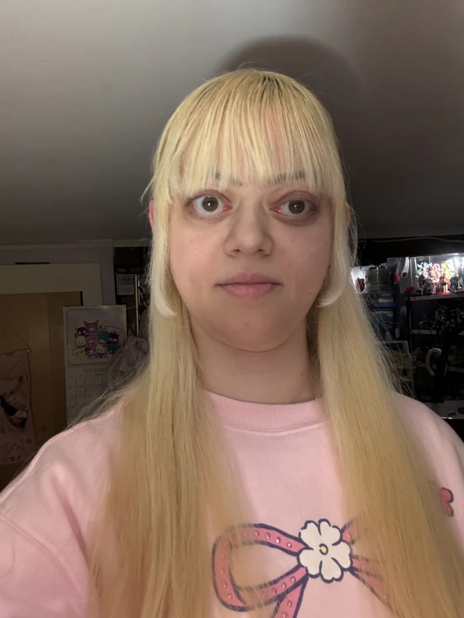 Zbog teške dijagnoze 50 puta je bila u bolnici