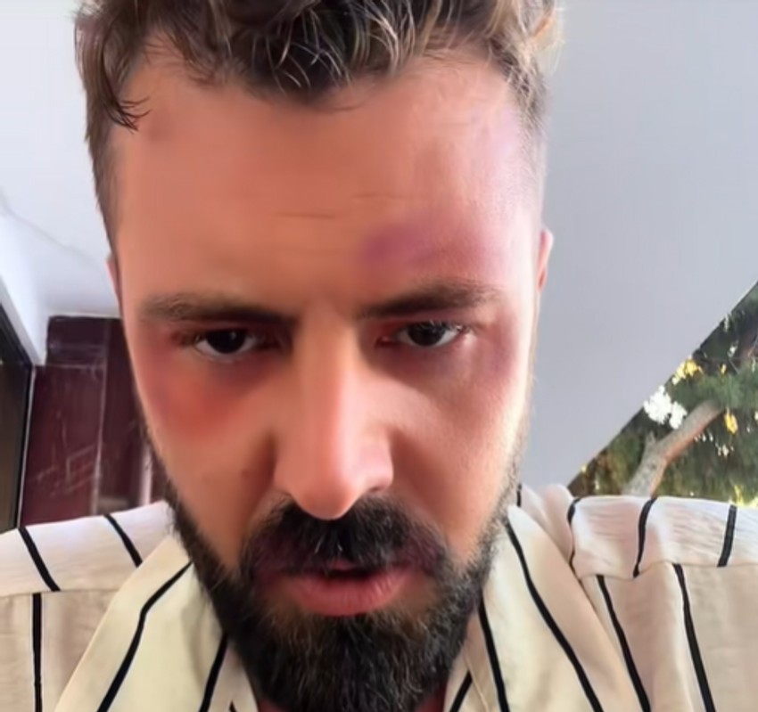 Pretučen pevač Goran Vujičić