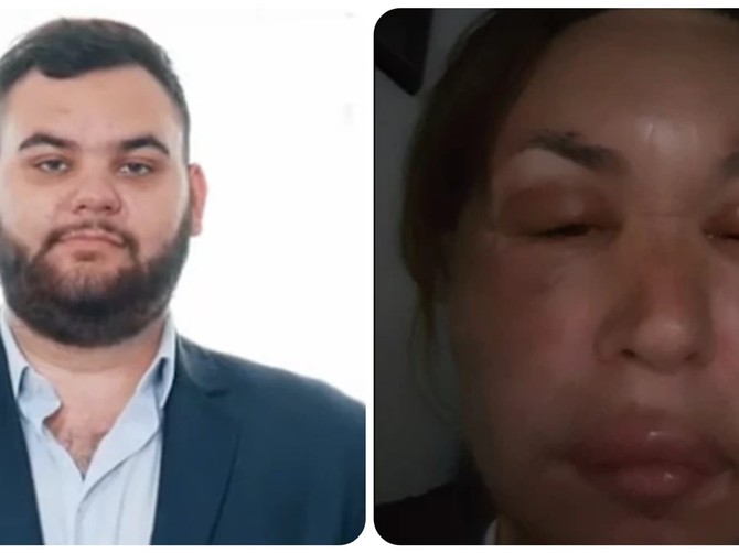 Prema rečima psihologa, Sava Knežević ima  disocijalni poremećaj ličnosti 