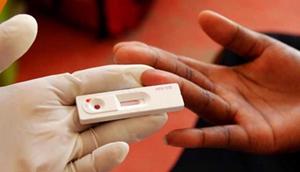 A HIV test kit