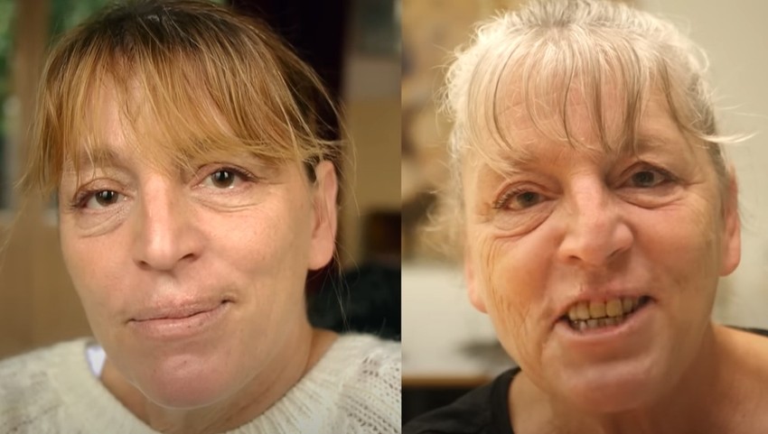 Razlika od 10 godina