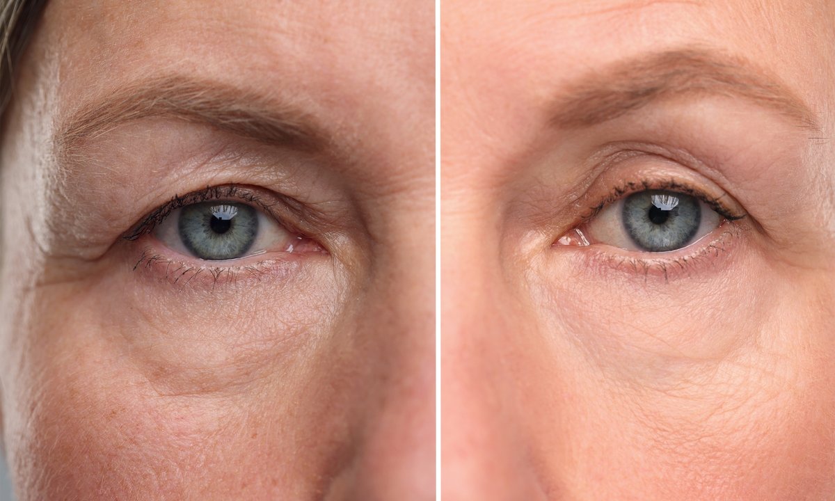Trzy silne kremy na opadające powieki. Działają jak "winda", a kosztują niewiele