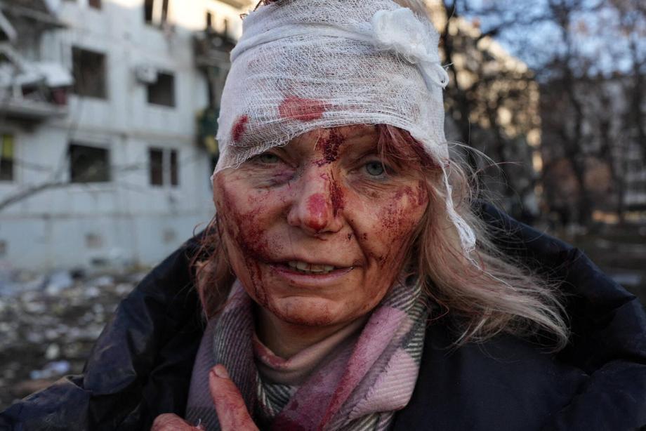 Jedna z pierwszych ofiar rosyjskiej agresji na Ukrainę została ranna podczas nalotu, który uszkodził część mieszkań pod Charkowem. 24 lutego 2022 r.