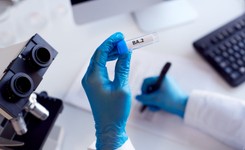 MZ w Izraelu: COVID-19 prawdopodobnie nigdy nie zniknie i zostanie z nami na zawsze