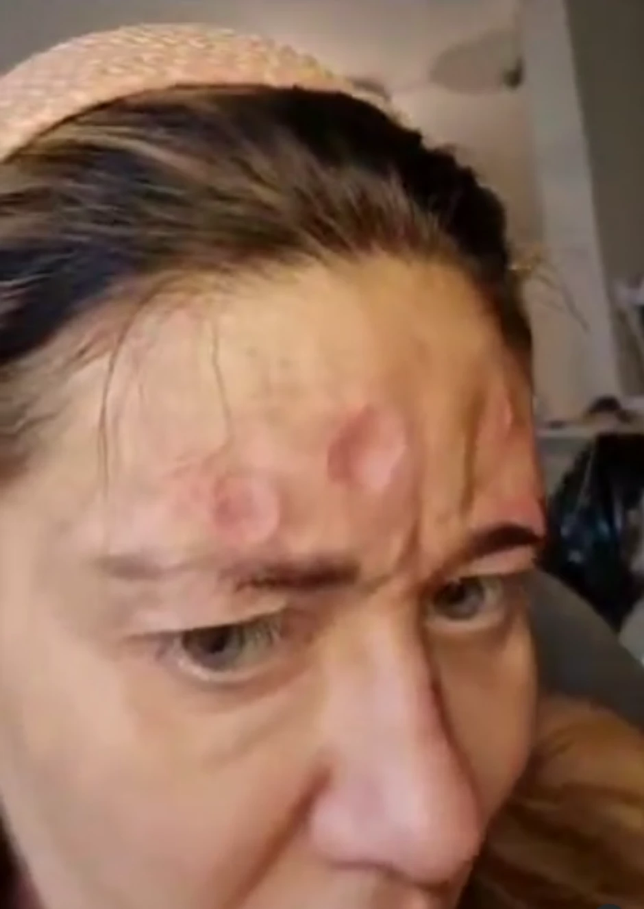 Ana Nikolić sa kožnim problemima