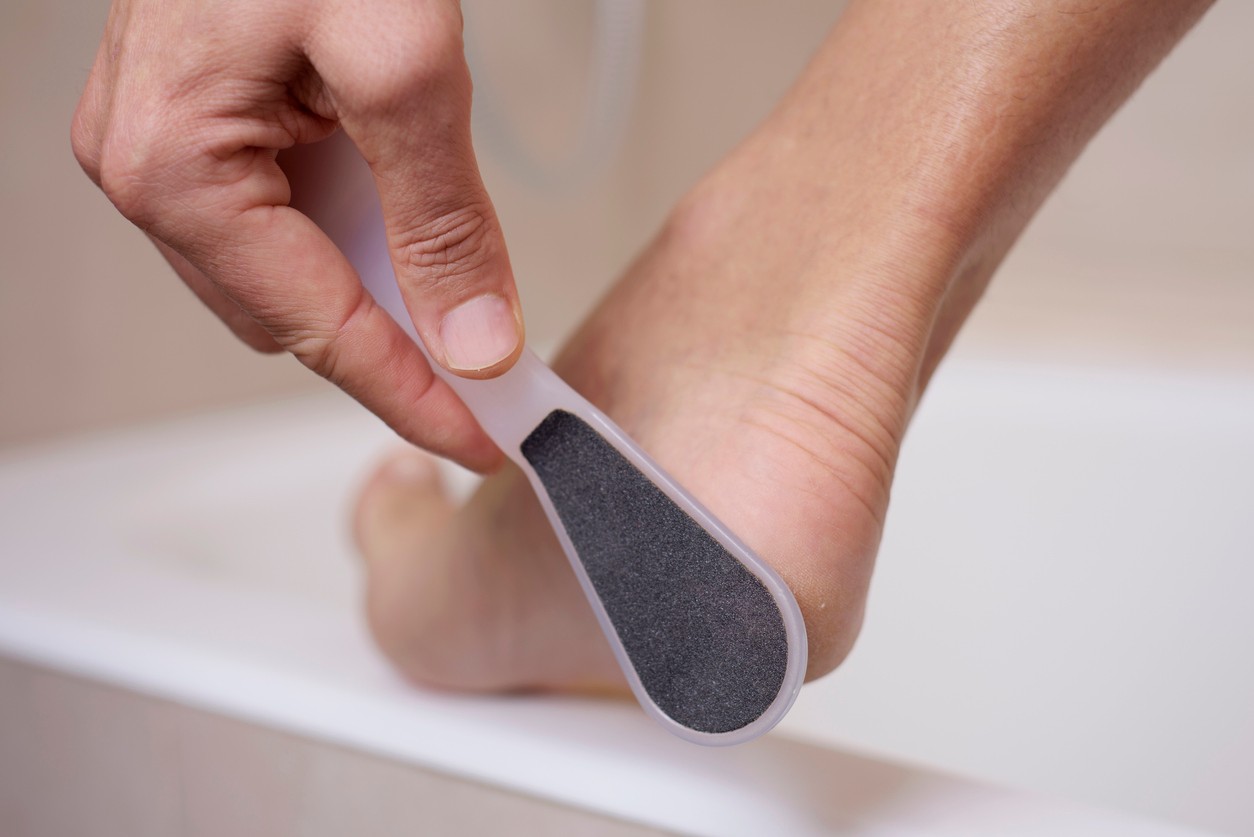 Ak nepatríte k fanúšikom chemických exfoliačných ponožiek, stavte na overenú mechanickú klasiku v podobe pemzy, manuálnych či elektrických pilníkov na päty.
