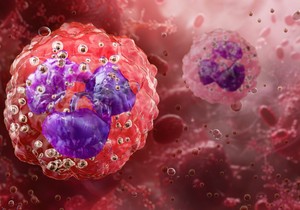 Neutrofilija je reakcija tela na niz problema