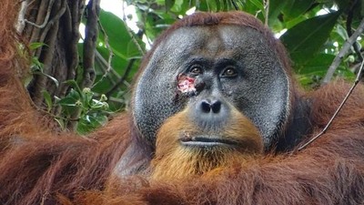 Rakus, a Sumatran orangutan living in Indonesia, chewed medicinal leaves and applied them to his own facial wound to speed healing.ARMAS/SUAQ PROJECT