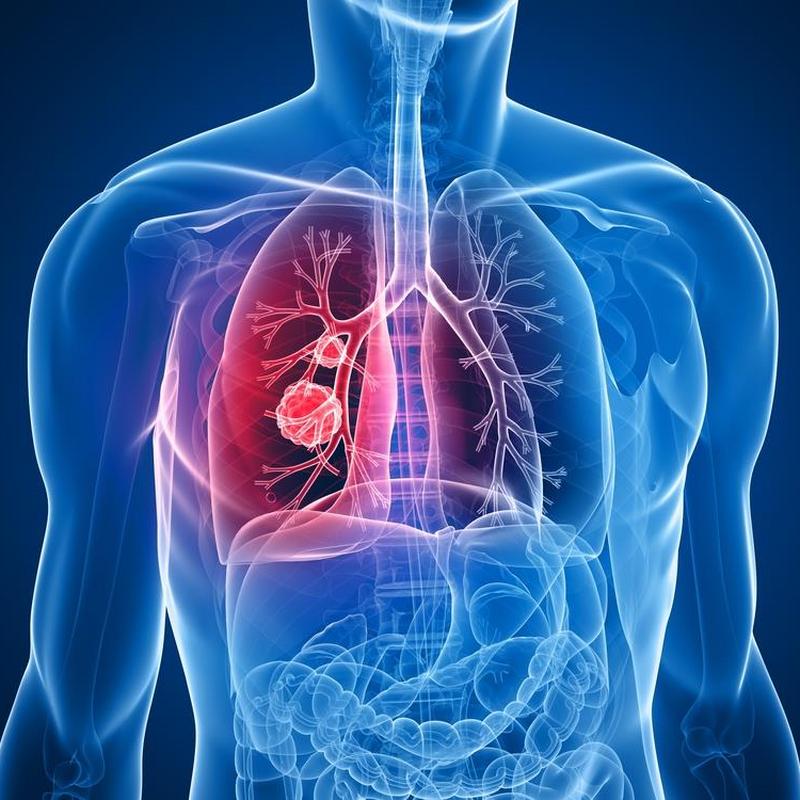 Płuca – budowa anatomiczna, najczęstsze choroby i funkcje w organizmie  [WYJAŚNIAMY]