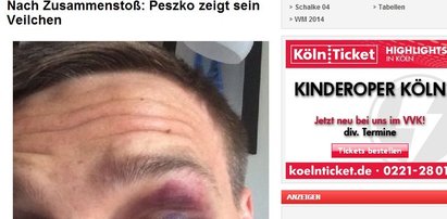 Peszko zaatakowany! Ma podbite oko