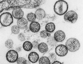 hantavirus-d00001591885090b0d771