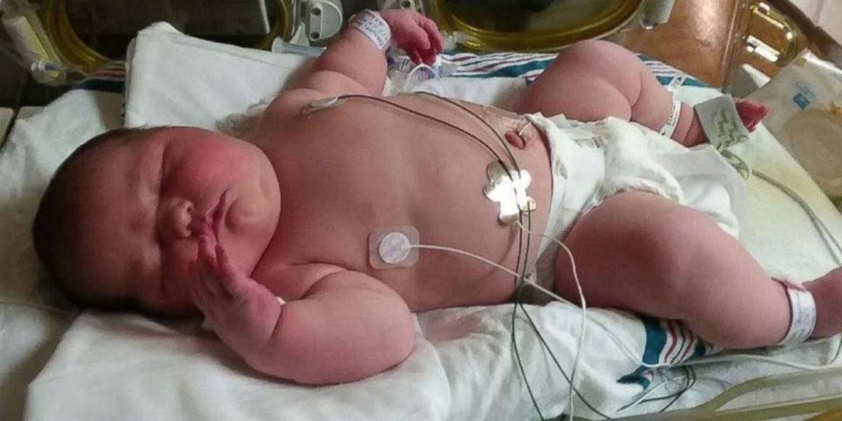 Urodziła córeczkę giganta. Niemowlę ważyło 6 kg