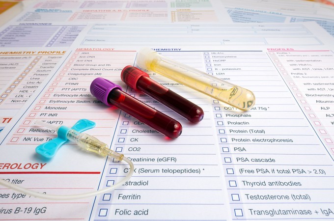 Mit mutat meg a vérkép? Ezekről árulkodnak a biomarkerek