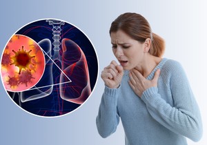 Kašalj je veoma čest simptom raka pluća