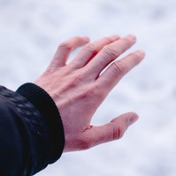 Vörös és viszket? Innen tudhatja, hogy téli bőrszárazság, vagy ekcéma az oka