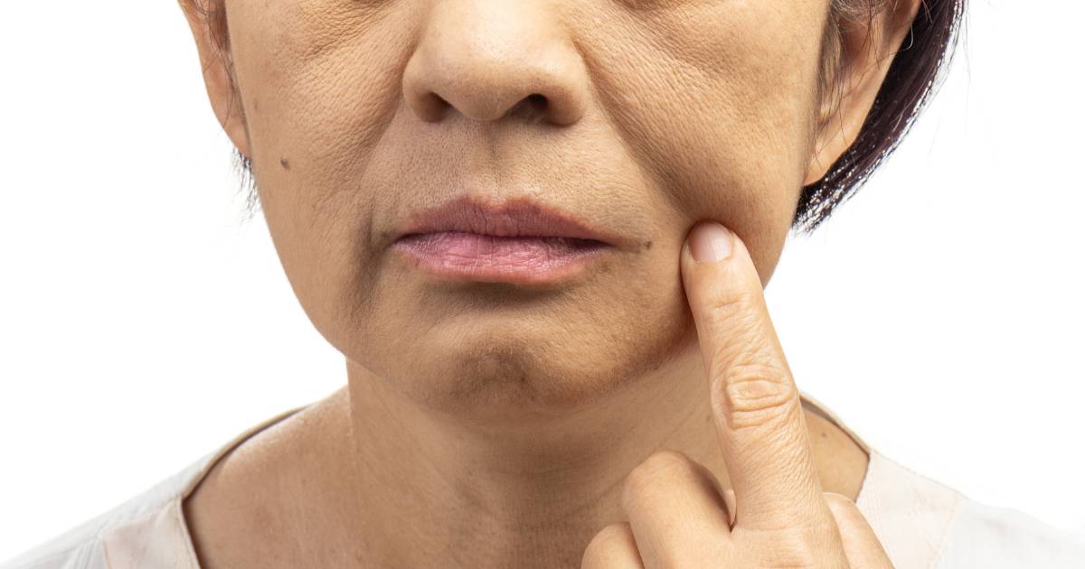 Ten krem to remedium na „chomiki” - modeluje owal twarzy, wypełnia zmarszczki i ujędrnia