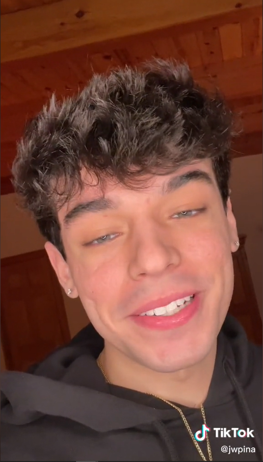 Jeho zvláštna anomália mu získala milióny zhliadnutí na sociálnej sieti TikTok. 