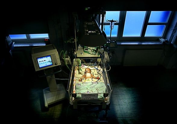 • Zdjęcie pojedyncze - III miejsce w kategorii ŻYCIE CODZIENNE

Autor: Paweł Relikowski, „Polska Gazeta Wrocławska”
Wrocław. Kilkudniowa Olga, u której lekarze przeprowadzili operację oddzielenia tchawicy od przełyku.
10 lutego 2009