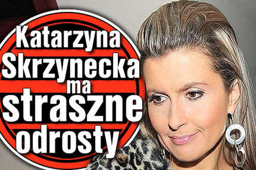 Skrzynecka ma straszne odrosty. Foto