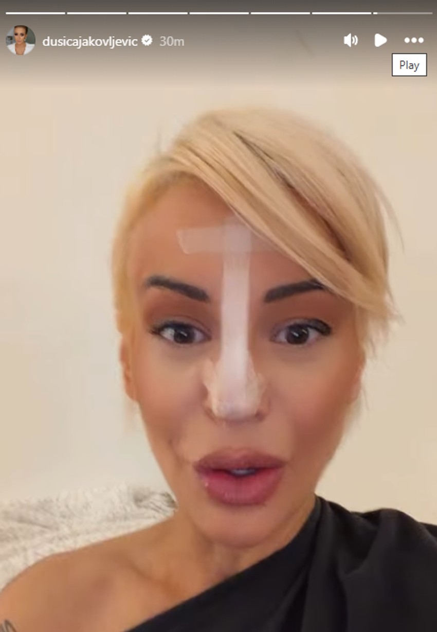 Dušica Jakovljević skroz oblepila nos flasterima, šokira: "Pao mi je vrh" nosa"
